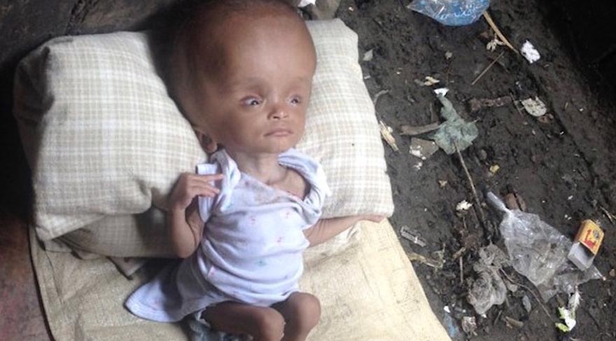 Haiti'de oldukça yaygın olarak görülen hydrocephalus rahatsızlığı, çoğunlukla ölümle sonuçlanıyor. Aileler, bu hastalıkla doğan çocukları istemeyerek sokağa atabiliyor ya da hastanelerde yeteri derecede bakım göremediklerinden çocuklar hayatlarını kaybedebiliyor. Ve bunlardan biri de ailesi tarafından terk edilen Nika.