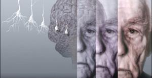 Alzheimer'dan korunmak mümkün