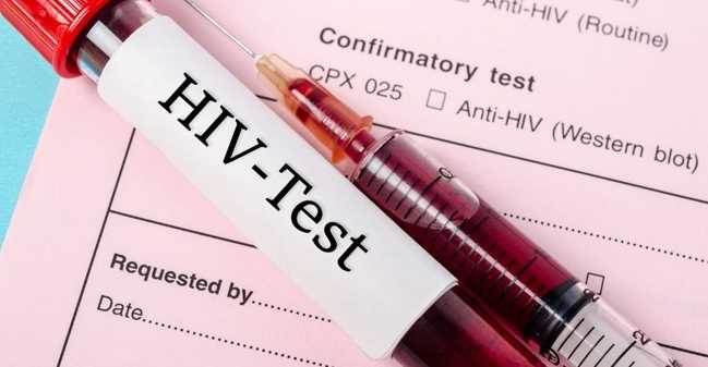 Türkiye'yi sarsan olay: AIDS'li damat adayının iğrenç planı!